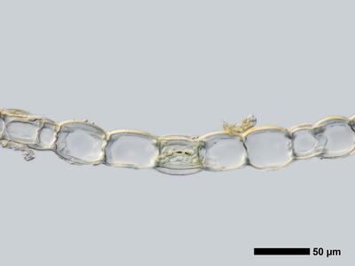 calypogeia muelleriana 1 flankenblatt quer detail