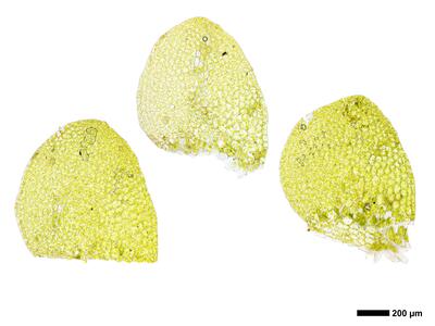 calypogeia muelleriana 2 flankenblatt