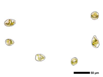 calypogeia neesiana 1 brutgemmen