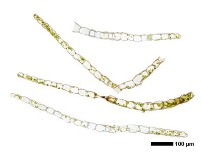 calypogeia neesiana 1 flankenblatt quer