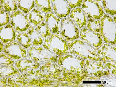 calypogeia sphagnicola 1 flankenblatt blattbasis