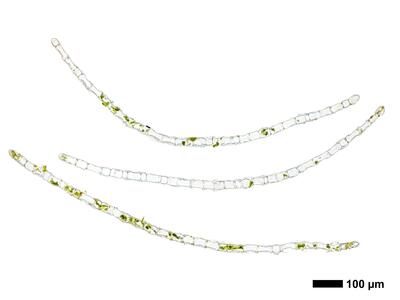 calypogeia sphagnicola 1 flankenblatt quer