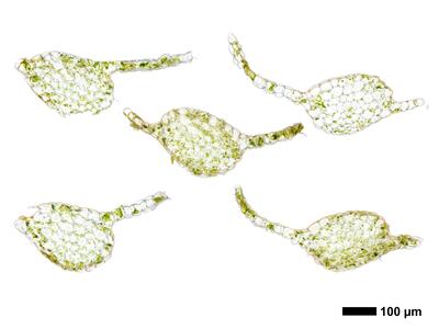 calypogeia sphagnicola 1 stamm quer