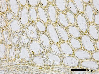 calypogeia suecica 1 flankenblatt blattbasis