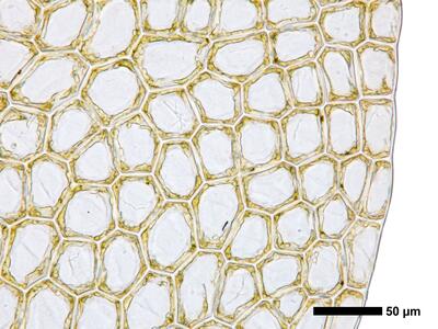 calypogeia suecica 1 flankenblatt blattrand