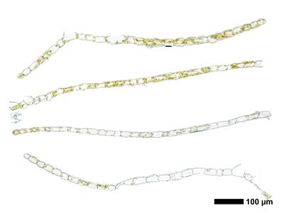 calypogeia suecica 1 flankenblatt quer