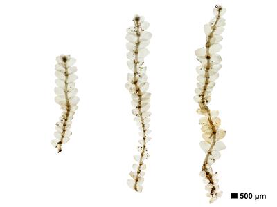 calypogeia suecica 1 habitus unterseite