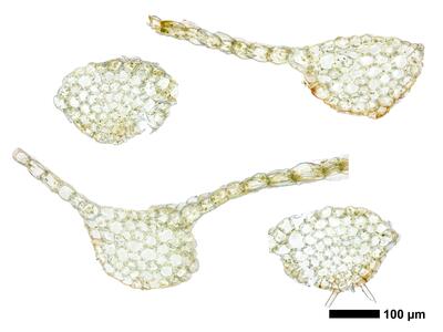 calypogeia suecica 1 stamm quer