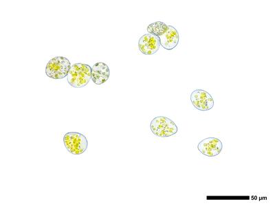 calypogeia suecica 2 brutgemmen