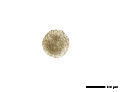 cephalozia bicuspidata 1 antheridium