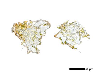 fuscocephaloziopsis loitlesbergeri 1 stamm quer