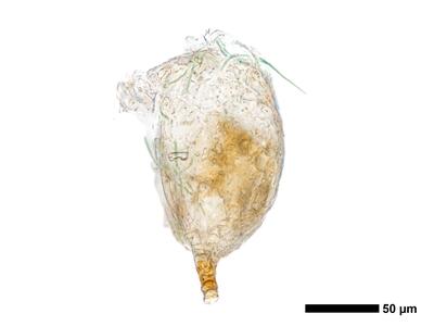 cephaloziella aspericaulis 1 antheridium