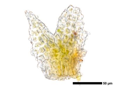 cephaloziella aspericaulis 1 flankenblatt zellen