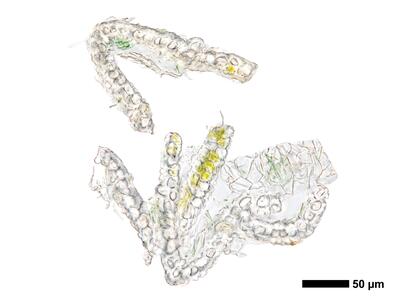 cephaloziella aspericaulis 1 perianth mitte quer