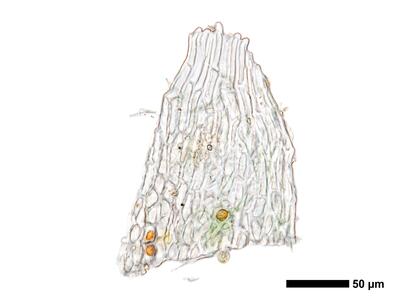 cephaloziella aspericaulis 1 perianthmuendung