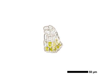cephaloziella aspericaulis 1 unterblatt