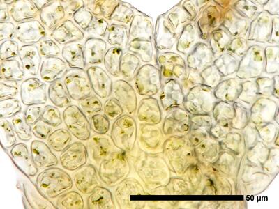 cephaloziella divaricata 1 flankenblatt zellen