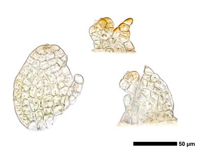 cephaloziella divaricata 1 unterblatt