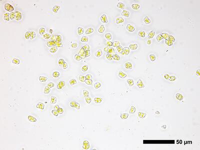 cephaloziella divaricata 2 brutgemmen