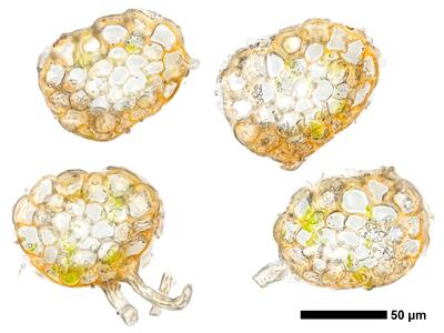 cephaloziella elachista 1 stamm quer
