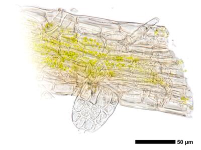 cephaloziella elachista 1 unterblatt