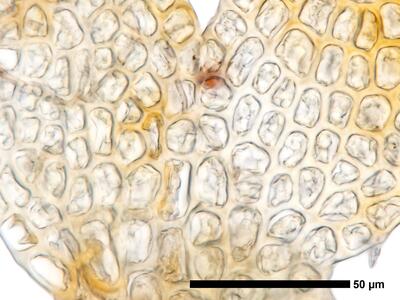 cephaloziella elegans flankenblatt zellen