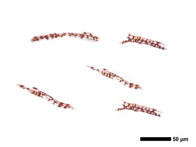 cephaloziella elegans kapsel quer