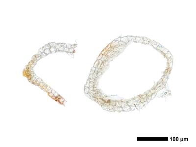 cephaloziella elegans perianth basis quer