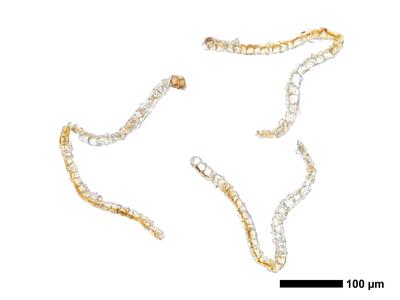 cephaloziella elegans perianth mitte quer