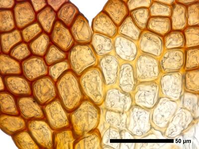 cephaloziella grimsulana 1 flankenblatt zellen