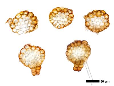 cephaloziella grimsulana 1 stamm quer