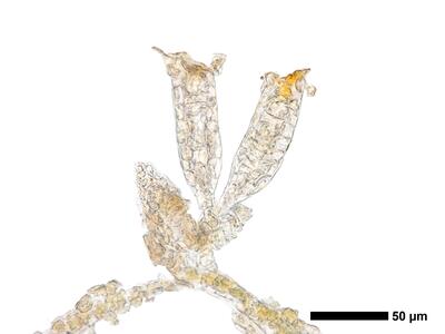 cephaloziella hampeana 1 archegonien