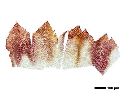 cephaloziella hampeana 1 female bract ring