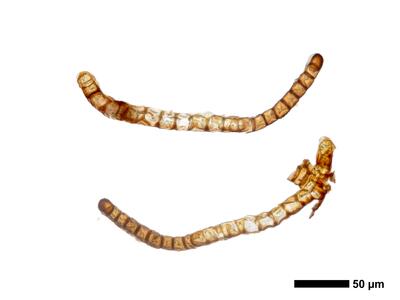 cephaloziella hampeana 1 flankenblatt quer