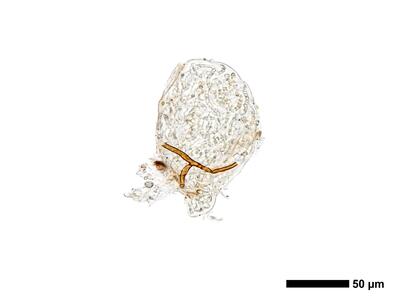 cephaloziella integerrima 1 antheridium