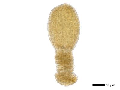 cephaloziella integerrima 1 archegonium