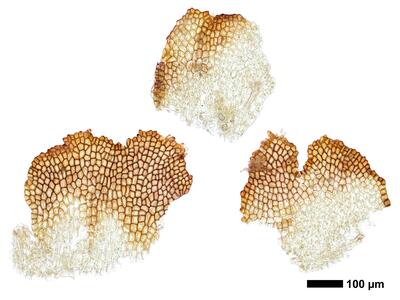 cephaloziella integerrima 1 female bract