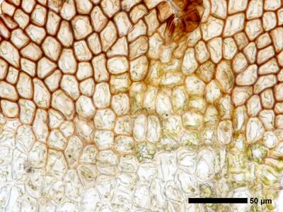 cephaloziella integerrima 1 flankenblatt zellen