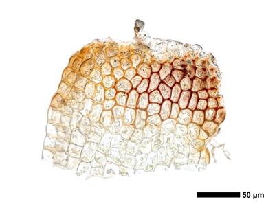 cephaloziella integerrima 1 male bract
