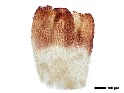 cephaloziella integerrima 1 perianth