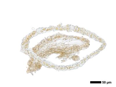 cephaloziella integerrima 1 perianth basis quer