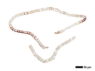 cephaloziella integerrima 1 perianth mitte quer