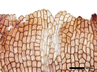 cephaloziella integerrima 1 perianthmuendung