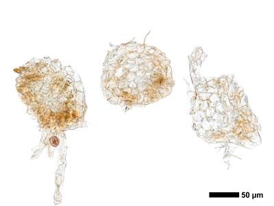 cephaloziella integerrima 1 stamm quer