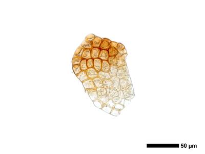 cephaloziella integerrima 1 unterblatt