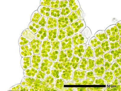 cephaloziella konstantinovae flankenblatt zellen blattrand