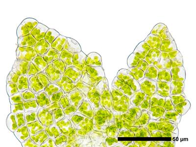 cephaloziella konstantinovae flankenblatt zellen blattspitze
