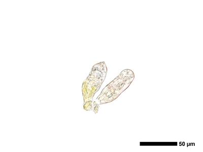 cephaloziella massalongi 1 archegonien