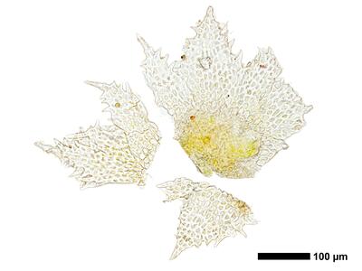 cephaloziella massalongi 1 female bract ring