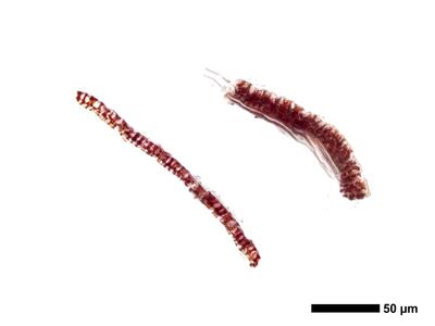 cephaloziella massalongi 1 kapsel quer